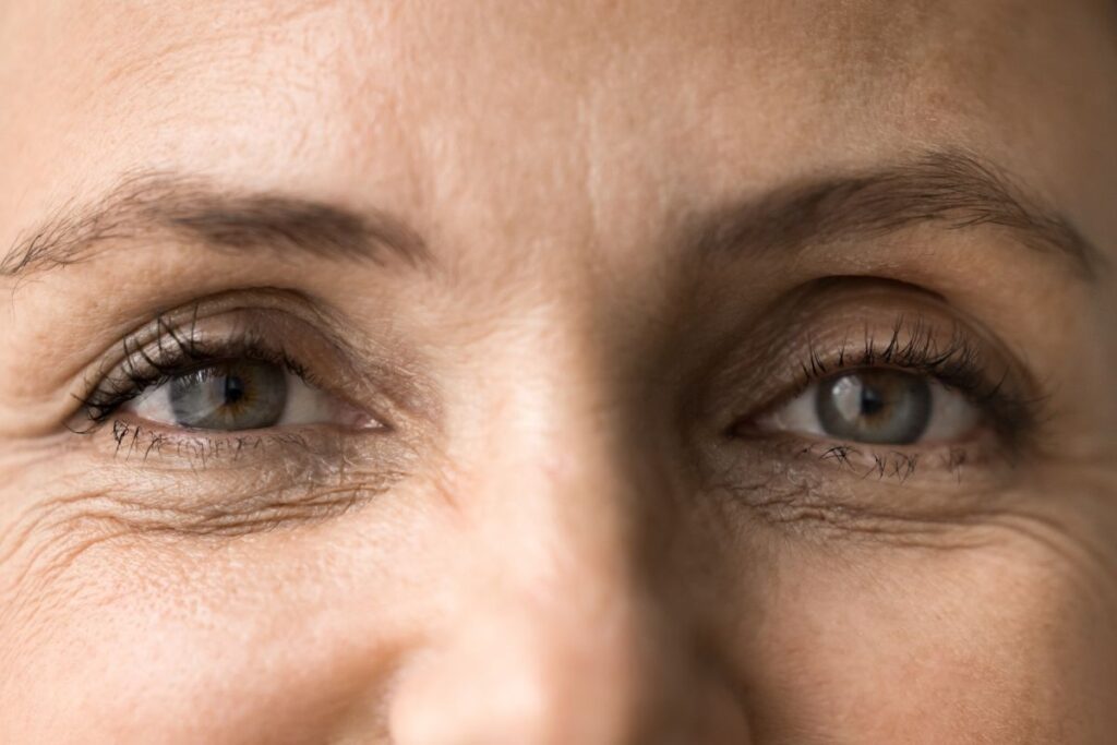 Close-up of a woman's eyes highlighting fine lines and wrinkles around the corners and under the eyes.